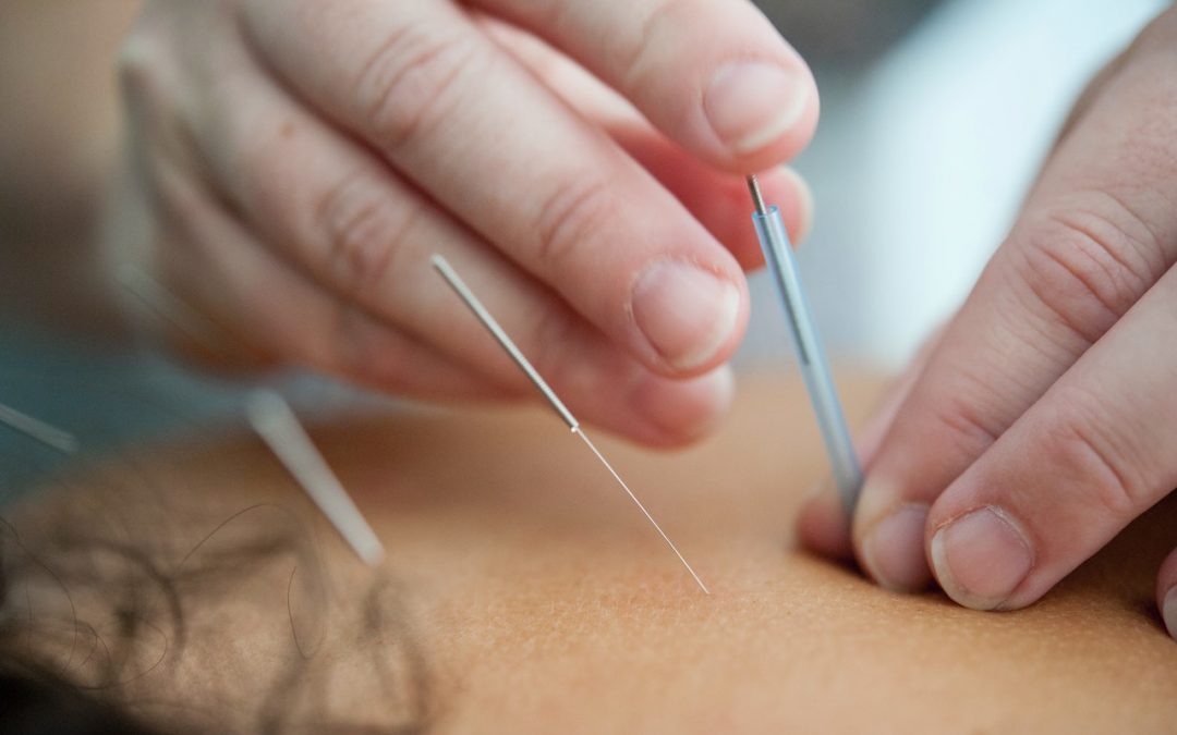 It’s raining needles – How can physiotherapists who practice acupuncture foster a healthier environment?